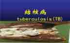 结核防治工作计划7篇