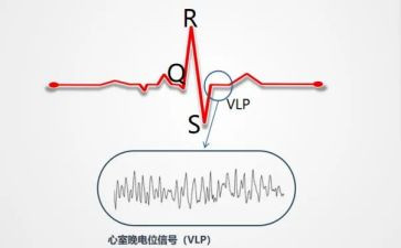 b超心电个人总结5篇